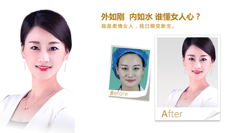 黄冈V脸、线雕隆鼻